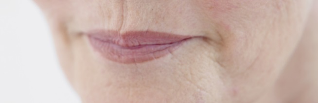 0719입가주름_w966