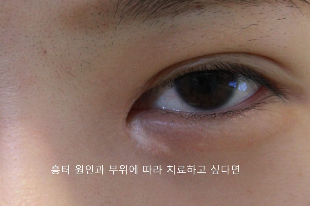 220504%EB%88%88%EB%B0%91%ED%9D%89%ED%84%B0_1