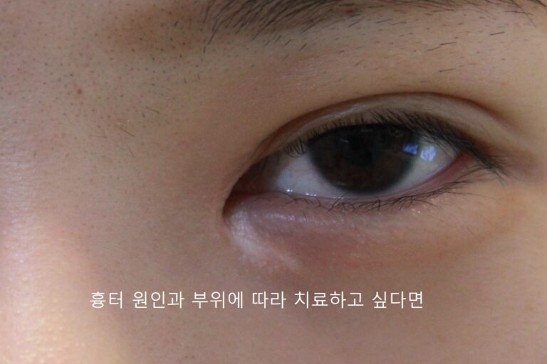 220504%EB%88%88%EB%B0%91%ED%9D%89%ED%84%B0_1