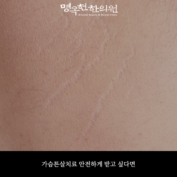 %EA%B0%80%ED%8A%BC%EC%8D%B8_w966