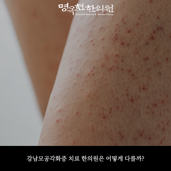 %EA%B0%95%EA%B0%81%EC%8D%B8_w966