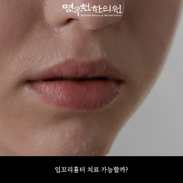 %EA%BC%AC%EB%A3%8C%EC%8D%B8_w966