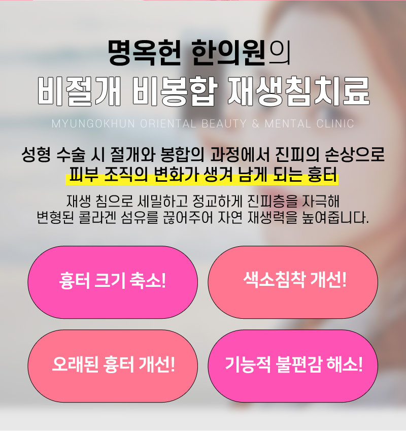 %EB%88%88_%ED%9D%89%ED%84%B0_%EC%83%81%EC%84%B8_w966