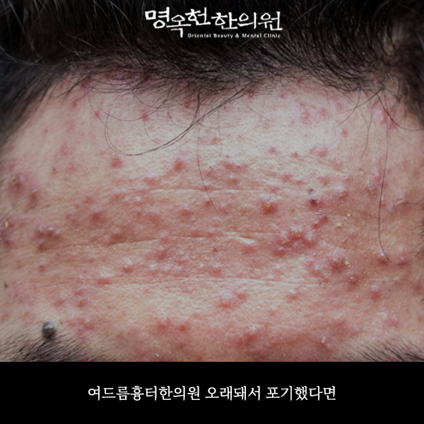 %EB%93%9C%EB%9E%98%EC%8D%B8_w966