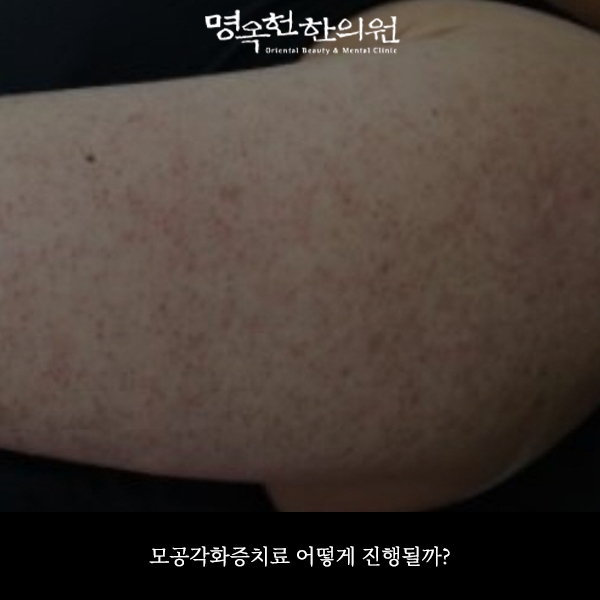 %EB%AA%A8%EA%B0%81%EC%8D%B8_w966