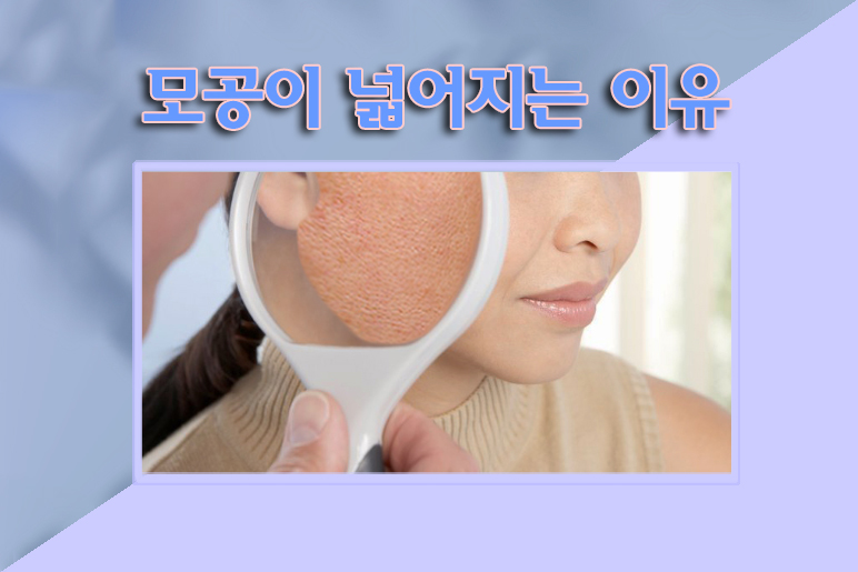 %EB%AA%A8%EA%B3%B5_w966