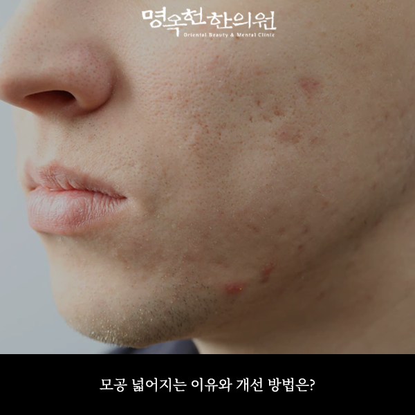 %EB%AA%A8%EB%84%93%EC%8D%B8_w966