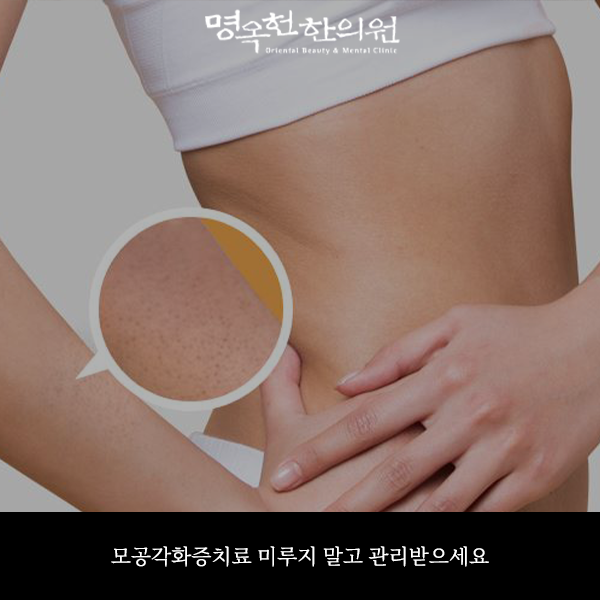 %EB%AA%A8%EC%B6%95%EC%8D%B8_w966