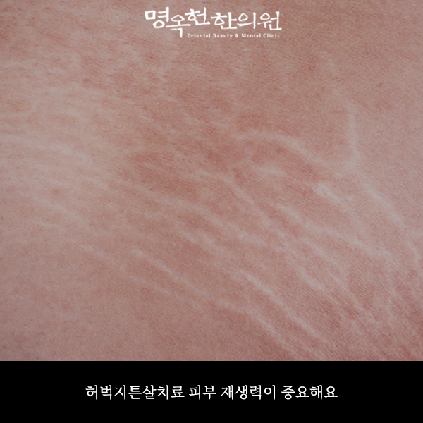 %EB%B2%85%ED%8A%BC%EC%8D%B8_w966