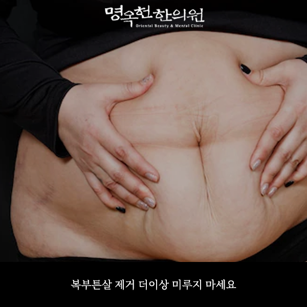 %EB%B3%B5%EC%A0%9C%EC%8D%B8_w966