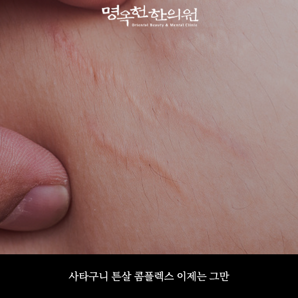 %EC%82%AC%ED%8A%BC%EC%8D%B8_w966