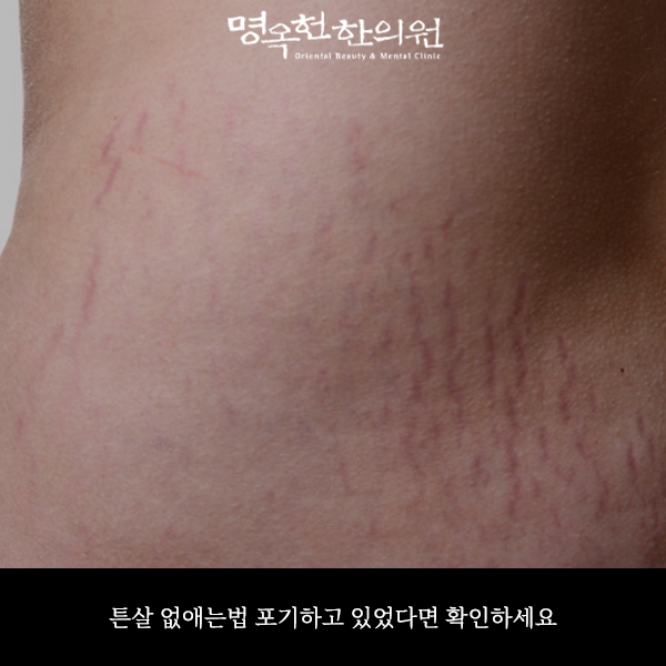 %EC%82%B4%EC%95%A0%EC%8D%B8_w966