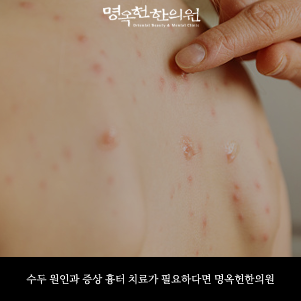 %EC%88%98%EC%9B%90%EC%8D%B8_w966