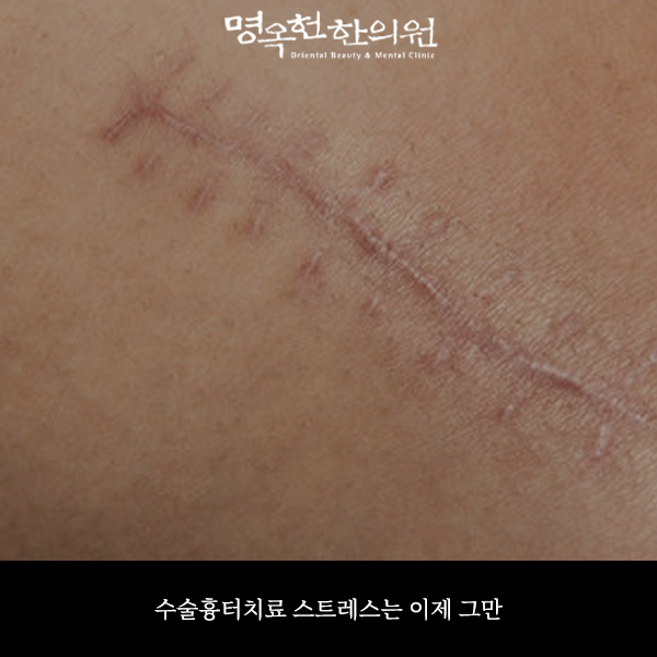 %EC%88%98%ED%84%B0%EC%8D%B8_w966