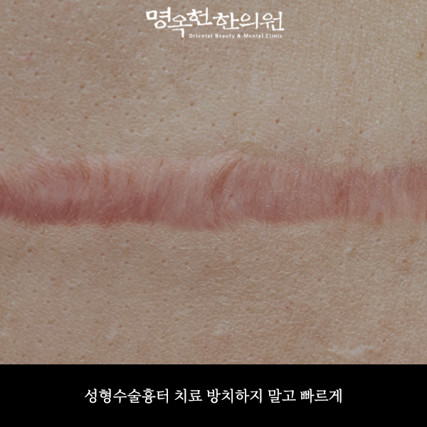 %EC%88%A0%ED%84%B0%EC%8D%B8_w966