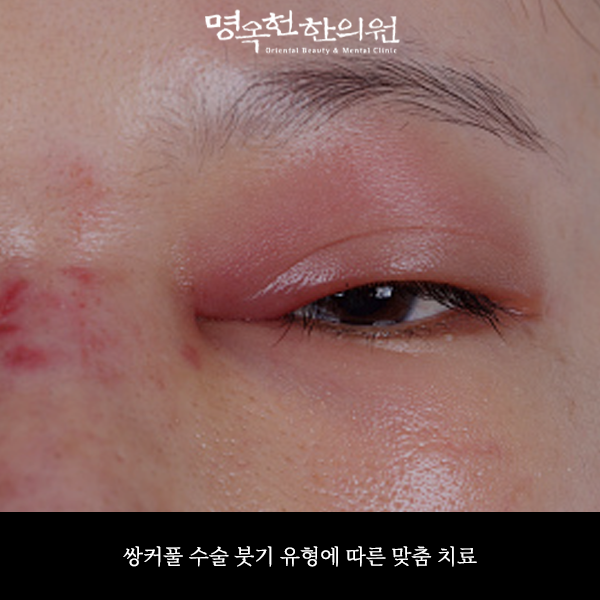 %EC%8C%8D%EC%88%A0%EC%8D%B8_w966