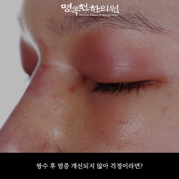 %EC%8C%8D%EC%97%BC%EC%8D%B8_w966