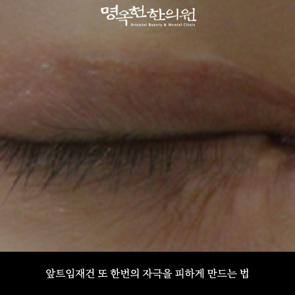 %EC%95%9E%EC%9E%AC%EC%8D%B8_w966