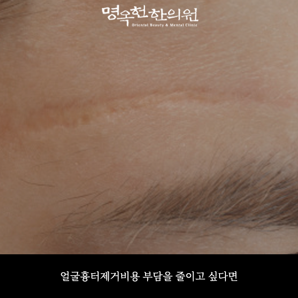 %EC%96%BC%EA%B1%B0%EC%8D%B8_w966