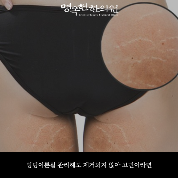 %EC%97%89%ED%8A%BC%EC%8D%B8_w966