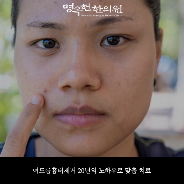 %EC%97%AC%EC%9A%B0%EC%8D%B8_w966