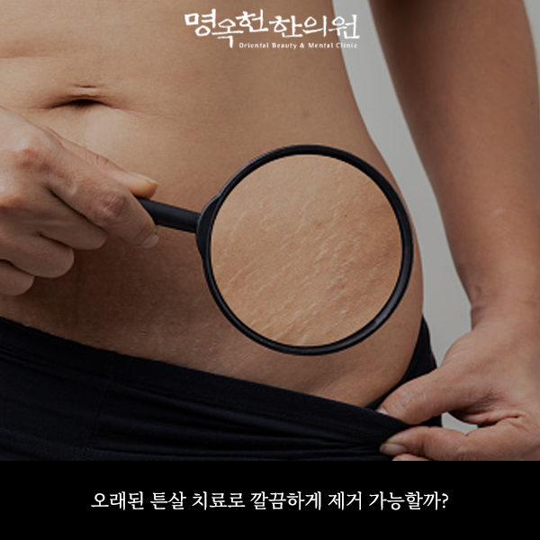 %EC%98%A4%ED%8A%BC%EC%8D%B8_w966