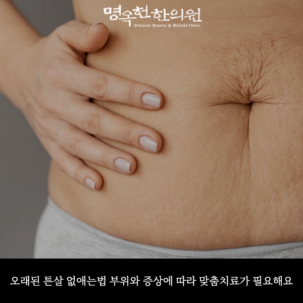 %EC%98%A4%ED%8A%BC%EC%8D%B8_w966