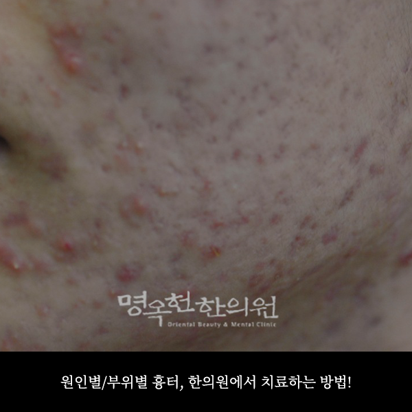 %EC%9B%90%EB%B6%80%EC%8D%B8_w966