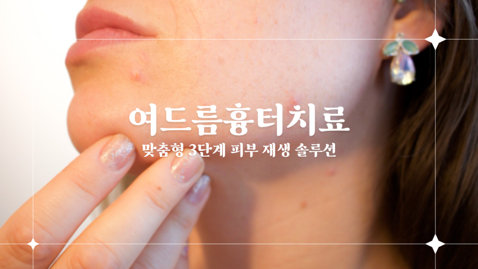 %EC%9B%A8%EB%94%A9_%EB%B8%8C%EC%9D%B4%EB%A1%9C%EA%B7%B8_%EC%9C%A0%ED%88%AC%EB%B8%8C_%EC%8D%B8%EB%84%A4%EC%9D%BC_w966