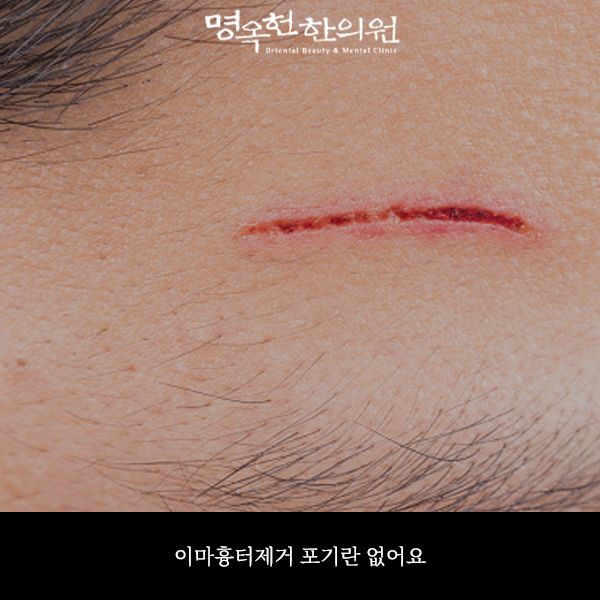 %EC%9D%B4%ED%9D%89%EC%8D%B8_w966