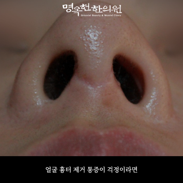 %EC%A0%9C%EA%B1%B0%EC%8D%B8_w966