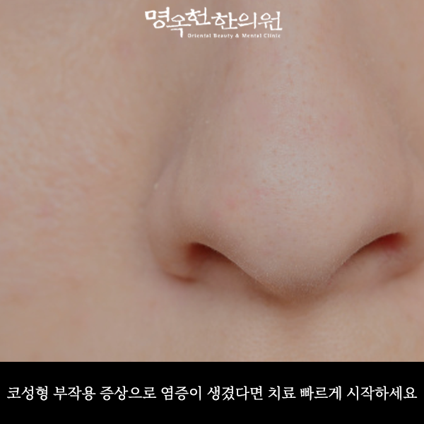 %EC%BD%94%EC%9E%91%EC%8D%B8_w966