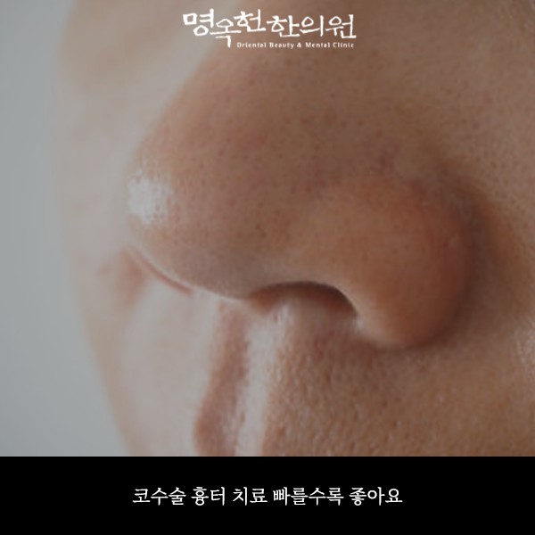 %EC%BD%94%EC%B9%98%EC%8D%B8_w966