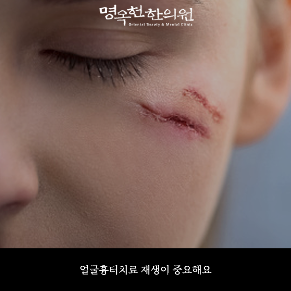 %ED%84%B0%EB%A3%8C%EC%8D%B8_w966