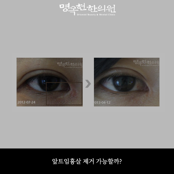 %ED%8A%B8%EA%B1%B0%EC%8D%B8_w966