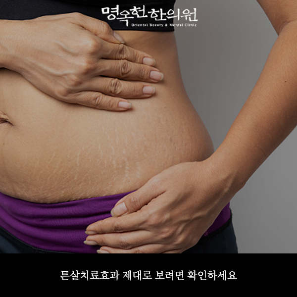 %ED%8A%BC%EB%A3%8C%EC%8D%B8_w966