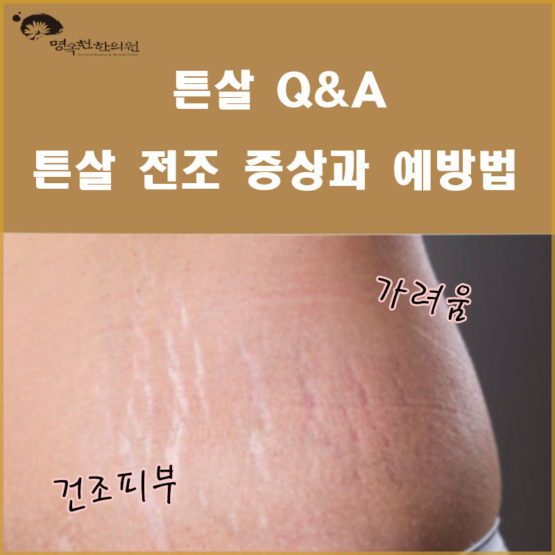 %ED%8A%BC%EC%82%B4_%EB%B8%94%EB%A1%9C%EA%B7%B8%EC%9A%A92_w966