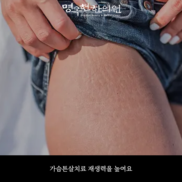 %ED%8A%BC%EC%B9%98%EC%8D%B8_w966