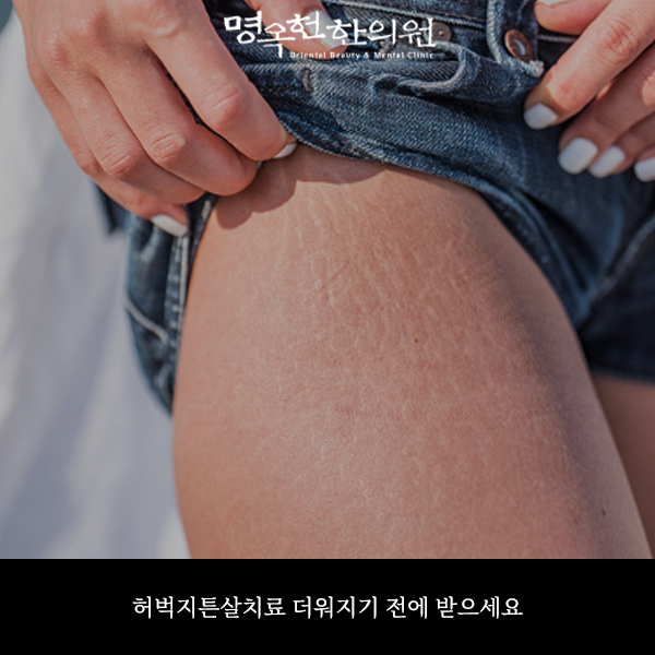 %ED%97%88%ED%8A%BC%EC%8D%B8_w966