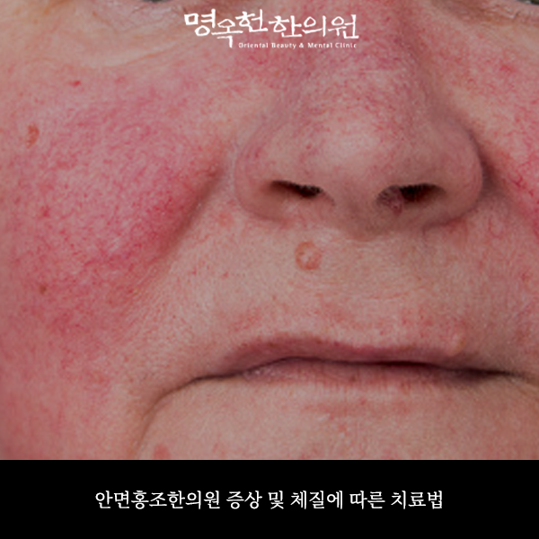 %ED%99%8D%EC%9D%98%EC%8D%B8