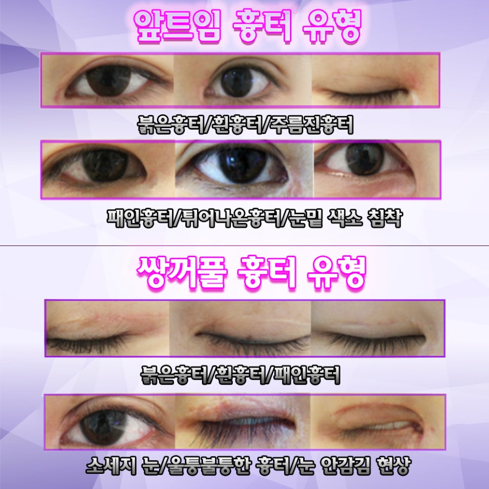 %ED%9D%89%ED%84%B0_%EC%9C%A0%ED%98%95_s_w966